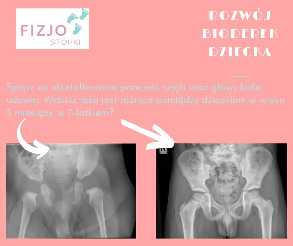 zdjecie rtg bioder